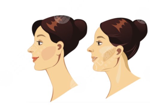 骨相抗衰怎么做？