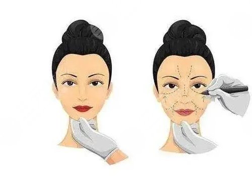 骨相抗衰怎么做？