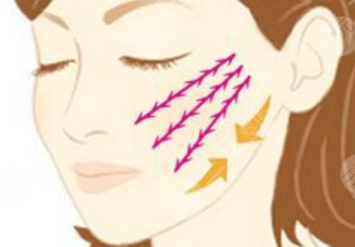 咬肌大怎么瘦下來