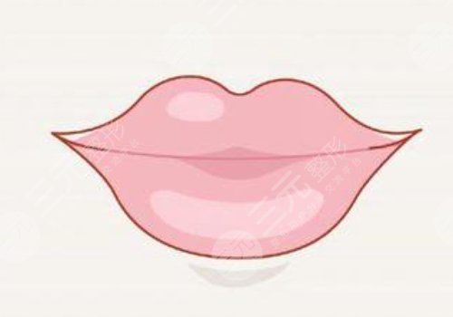 微笑唇打玻尿酸能保持多久？