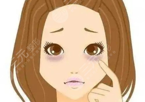 去黑眼圈和眼袋有效的方法是什么？眼周抗衰指南！