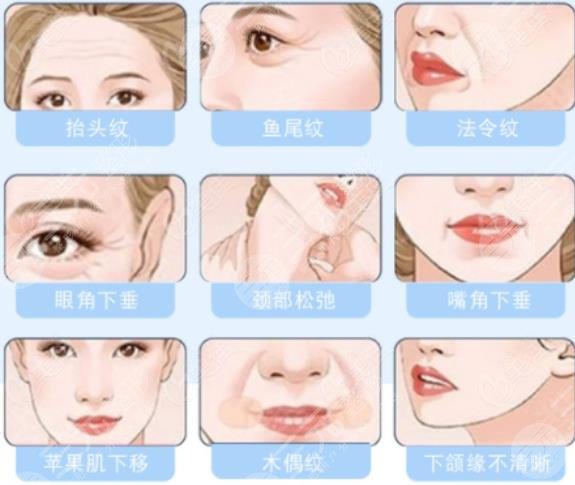 雙矢量提升術(shù)多大歲數(shù)能做