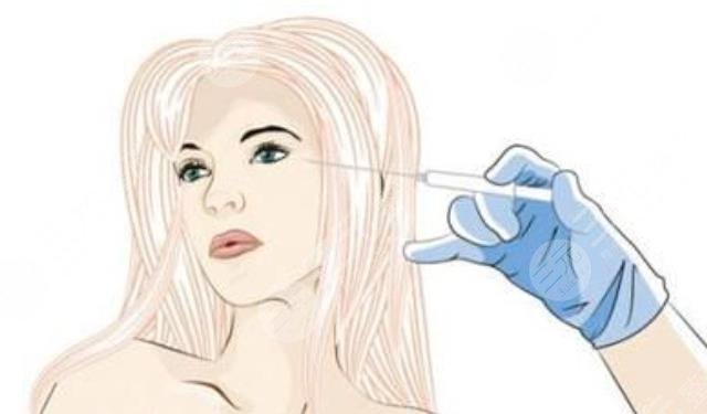 內(nèi)外輪廓固定