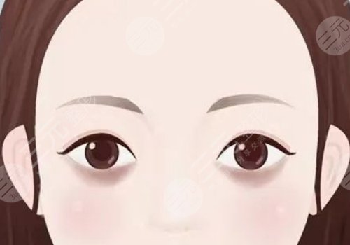 去黑眼圈手術(shù)多少錢??？