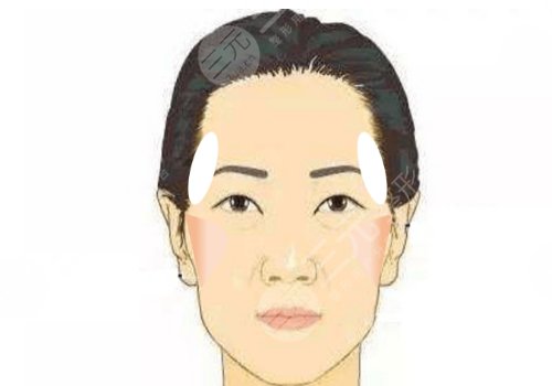 中庭太長怎么改良？