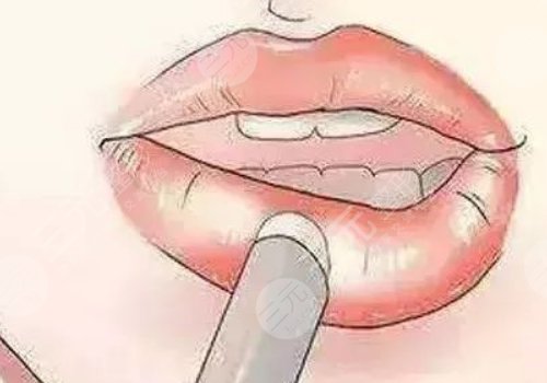 唇部老化的原因有哪些？唇部老化如何改良？