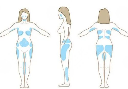 身體塑形能達(dá)到減肥的效果嗎？