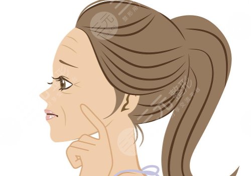 動態(tài)紋和靜態(tài)紋哪個屬于真性皺紋？