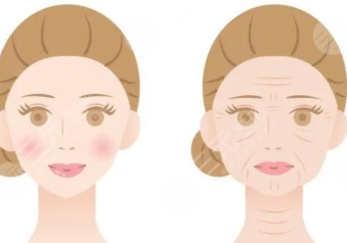 動態(tài)紋和靜態(tài)紋哪個屬于真性皺紋？