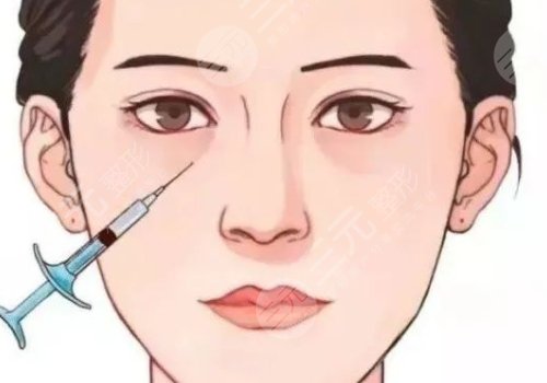 雙美膠原蛋白填充淚溝能維持多久？