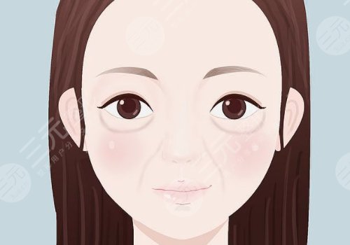 雙美膠原蛋白填充淚溝能維持多久？