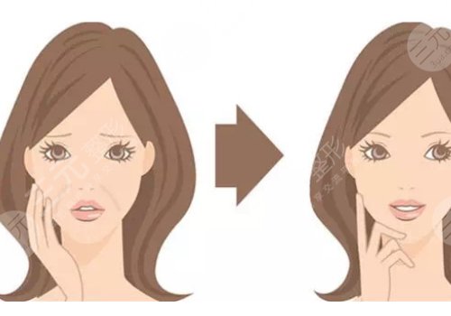 面中凹陷是什么原因