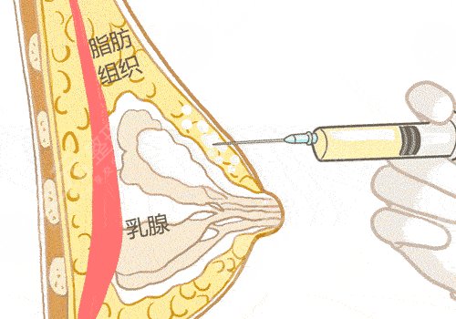 廣州市荔灣區(qū)人民醫(yī)院整形美容科怎么樣？