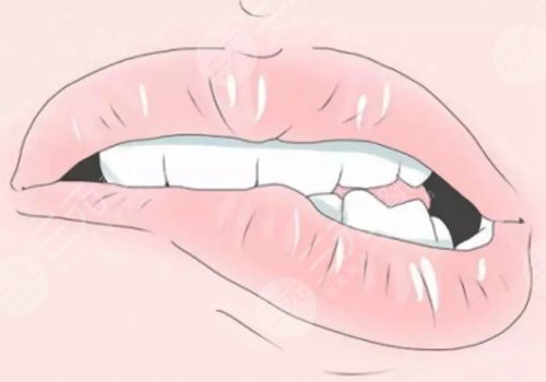 唇部老化的表現(xiàn)有哪些？改良方法有這些！