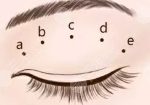 廣州可玉醫(yī)療美容醫(yī)院羅勇怎么樣？