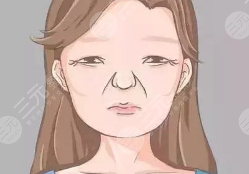 括號紋怎么去掉？怎么形成的？改良方式解讀！