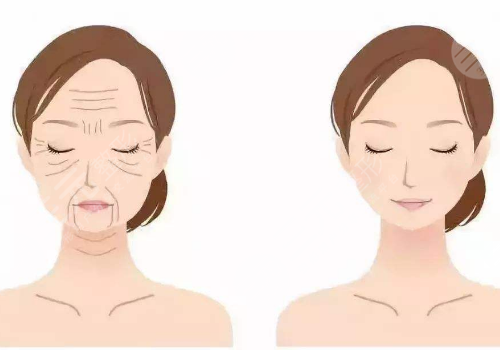 動態(tài)紋和靜態(tài)紋的區(qū)別