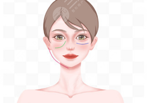 動態(tài)紋和靜態(tài)紋的區(qū)別