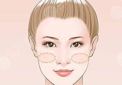 動態(tài)紋和靜態(tài)紋的區(qū)別、