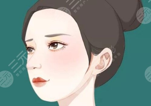 動態(tài)紋和靜態(tài)紋的區(qū)別