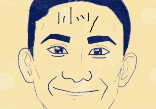 抬頭紋怎么去除有效男生？