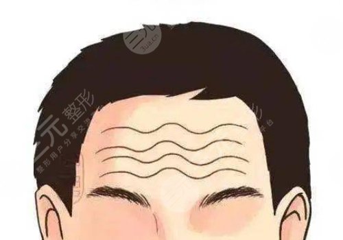 抬頭紋怎么去除有效男生？