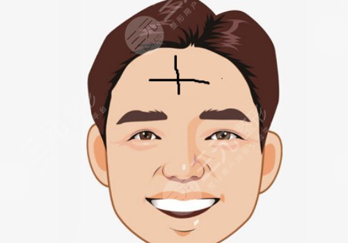 抬頭紋怎么去除有效男生？