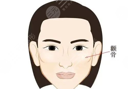 上海輪廓固定哪個醫(yī)生做的好