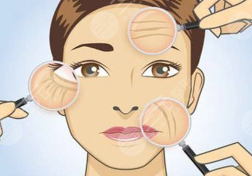 抬頭紋去除手術(shù)需要多少錢？