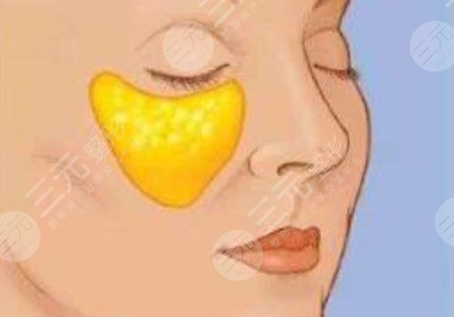 眼窩凹陷用什么填充好？