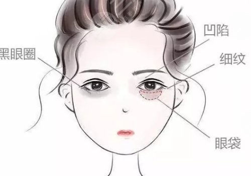 眼窩凹陷用什么填充好？