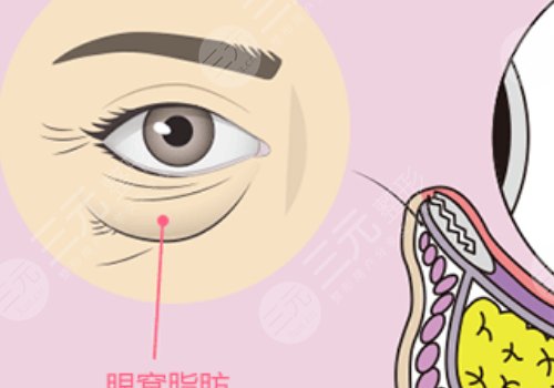 眼窩凹陷用什么填充好？