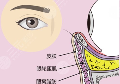 眼窩凹陷用什么填充好？