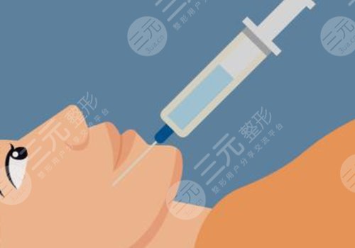 玻尿酸填充下巴有什么副作用？