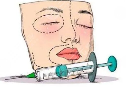 玻尿酸填充下巴有什么副作用？