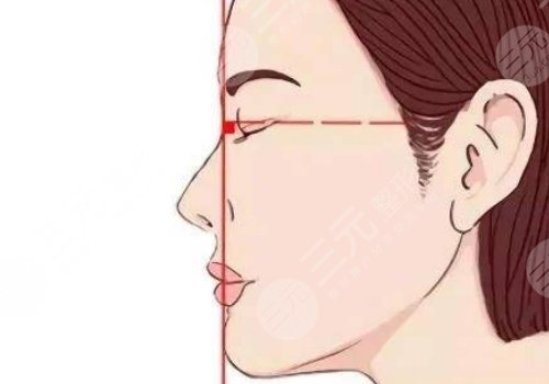 下頜線提升前后對比圖