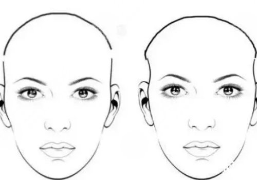 假體填充太陽凹大概多少錢？