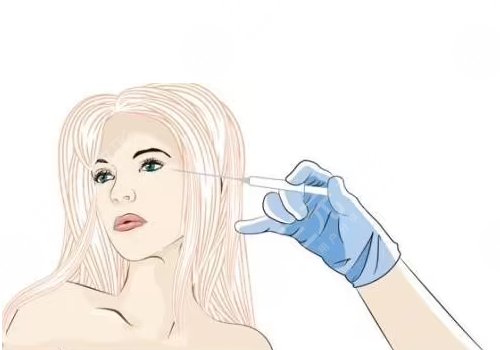 玻尿酸填充太陽凹大概多少錢？