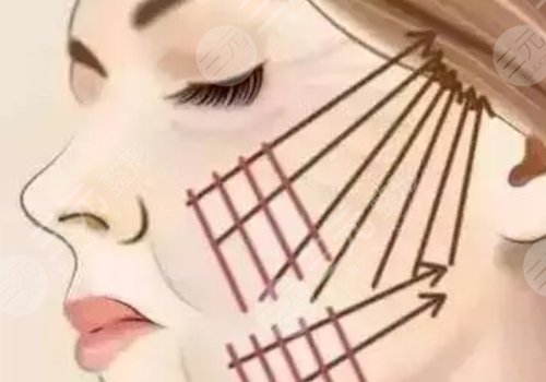 面部提升術(shù)的危害有什么？