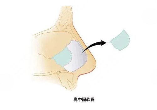 靳玉彪做的鼻子怎么樣？