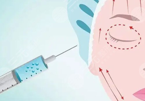 玻尿酸填充位置移動(dòng)怎么辦？