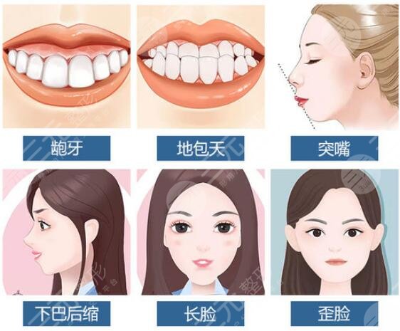 嘴凸法令紋重可以整形嗎？3種改良方案分享，醫(yī)美不盲目！