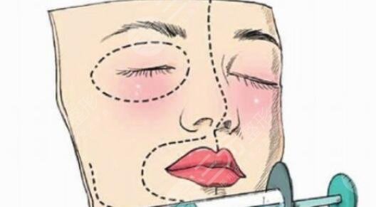 內(nèi)輪廓固定