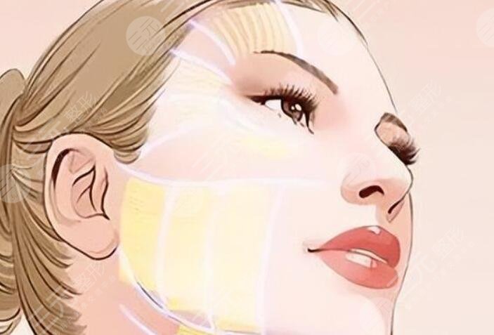 內(nèi)輪廓固定外輪廓固定