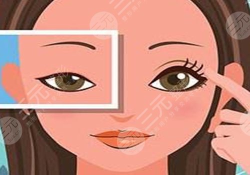 做眼部提拉手術(shù)能維持多久？