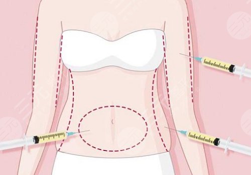 潘紅偉醫(yī)生有名嗎？