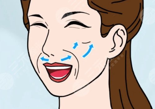 小拉皮手術(shù)好處和壞處有哪些？