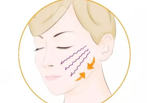 小拉皮手術(shù)好處和壞處有哪些？