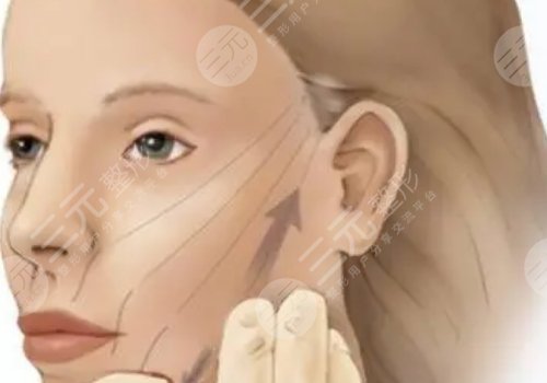 筋膜懸吊提升術(shù)能保持多久