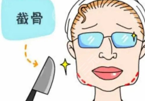 臉部骨骼歪斜怎么矯正？